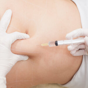 Is Fat Melting Injections Painful Compared to Other Methods?