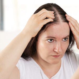 Is Hair Replacement a Good Option for Women Too?