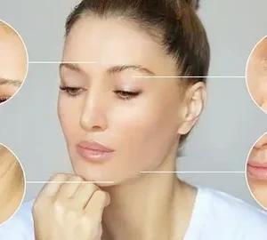 Morpheus8 Results