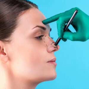 Rhinoplasty in Dubai