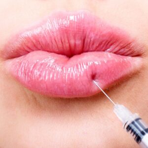 Juvederm Fillers in Dubai