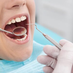 Tooth Filling Cost in Dubai