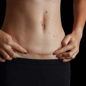 Abdominoplasty in Islamabad