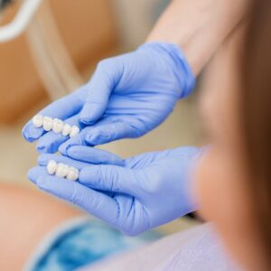 Dental Crowns and Bridges in Dubai