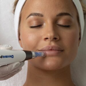 Dermapen A Minimally Invasive Way to Gorgeous Skin