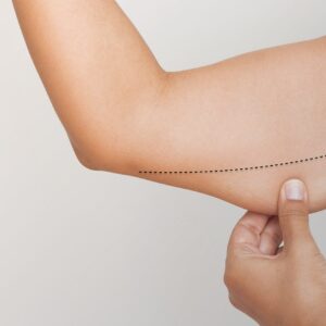 Get Rid of Excess Arm Fat with Surgery