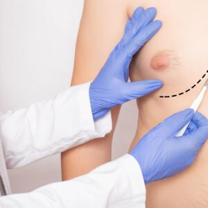 Gynecomastia Surgery in Islamabad