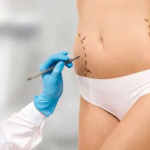 Liposuction in Islamabad