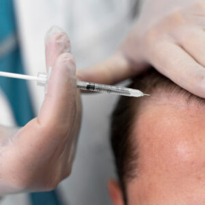 Hair Specialist Doctor in Dubai