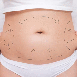 Tummy tuck cost Islamabad