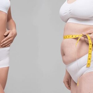 Weight Loss treatment in Islamabad