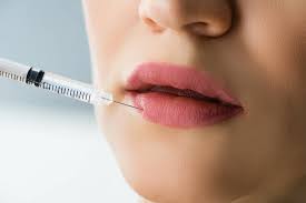 Who Is a Good Candidate for Lip Fillers?
