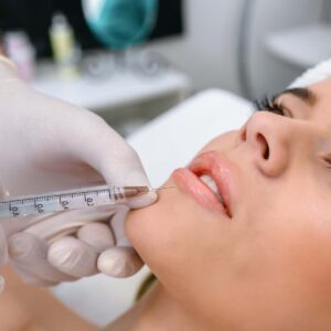 Best Lip Fillers Injections in Dubai