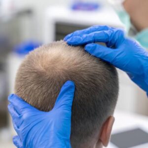 Hair Specialist Doctor in Dubai