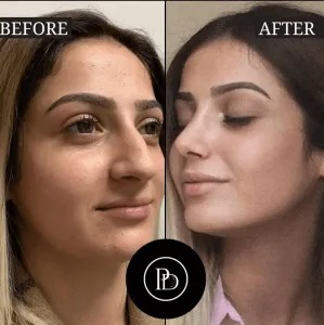 The Science Behind PRP Treatment in Dubai Explained