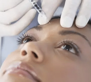 Botox Transform Your Skin with Ease