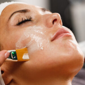 Chemical Peel in Islamabad