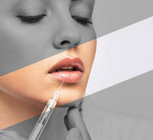 Do Lip Fillers Injections Worth the Cost?