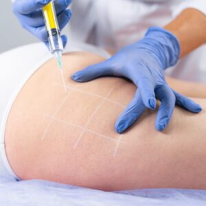 How Painful Are Fat Dissolving Injections Really?
