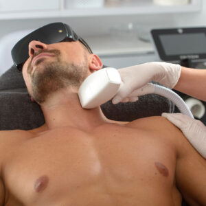 How Permanent Is Men’s Laser Hair Removal Treatment