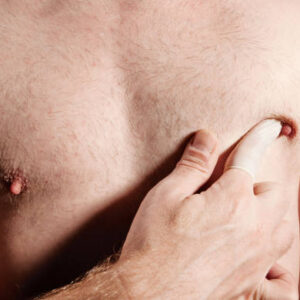 Is Gynecomastia Surgery Safe for Teenagers