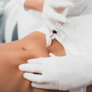 Long-lasting Results with Fat Injections