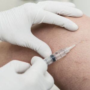 Restore Circulation with Sclerotherapy