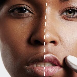 Skin whitening in Islamabad