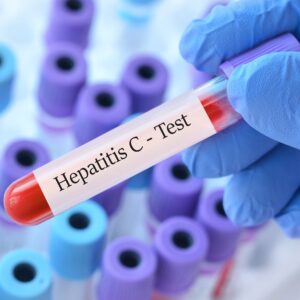 Hepatitis C Test in Dubai