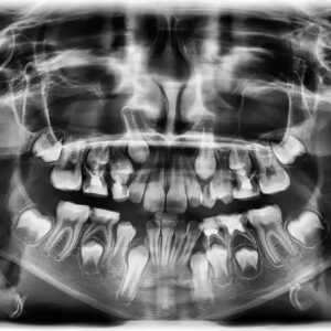Panoramic Dental X-Ray Cost in Dubai
