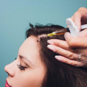 Best PRP Hair Treatment in Dubai