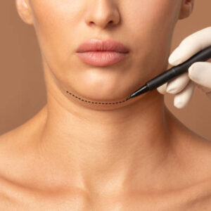 How Effective Is Double Chin Removal Surgery?