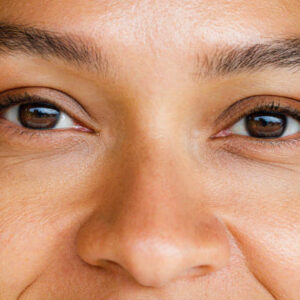 How Long Does Rhinoplasty Surgery Take?