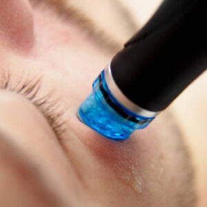 How Often Should You Get a HydraFacial Done?