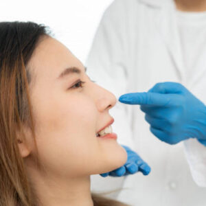 Is Alarplasty a Permanent Solution for Nose Contour?