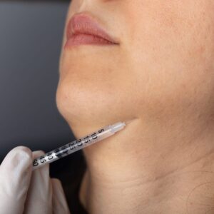 Jawline Filler Injections for Long Lasting Results