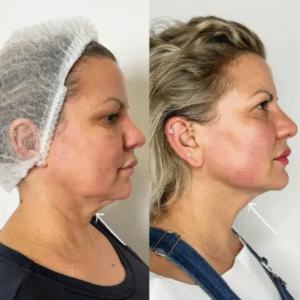 Why Choose the Best Plastic Surgeons in Dubai for Your Aesthetic Journey