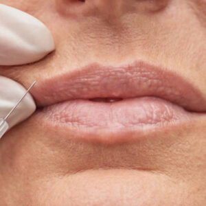 What Benefits Do Wrinkle Smoothing Injections Offer?