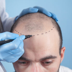 Front Line Hair Fixing