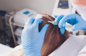 Best Hair Fillers Solutions for Thinning Hair