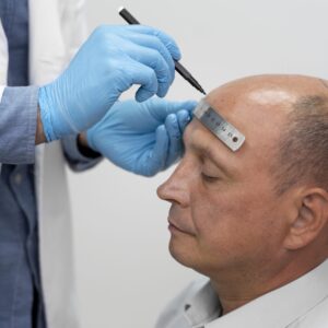 Discover the Power of Advanced FUE Hair Restoration