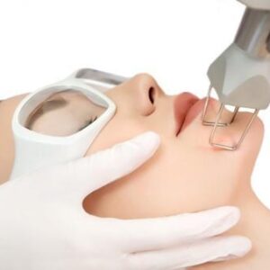 Fractional CO2 Laser Therapy for Sun Damage