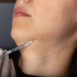 Jawline Definition Made Easy