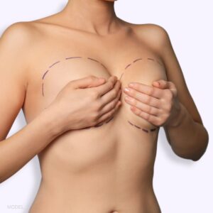 Long-Lasting Beauty with Breast Lift Surgery