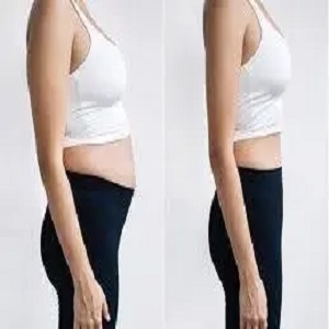 حقن مونجارو