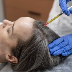 Non-Surgical Hair Restoration Options