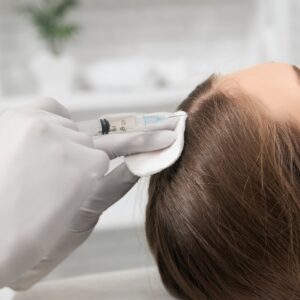 Best PRP Hair Treatment