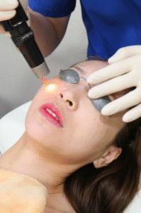 Pico Laser Therapy for Sun Damage