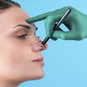 جراحة تجميل الأنف