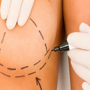 Safe and Effective Breast Enhancement Injections